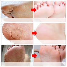 Load image into Gallery viewer, Exfoliating Foot Peeling Mask
