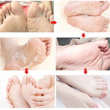 Load image into Gallery viewer, Exfoliating Foot Peeling Mask
