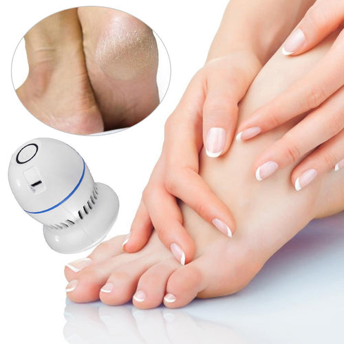 Rechargeable Electric Dead Skin Remover